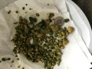 Calculs évacués suite au nettoyage du foie 